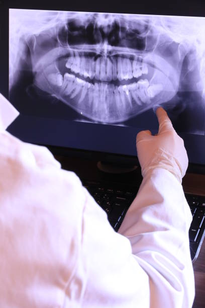 Best Emergency Treatment for Oral Infections in Spirit Lake, IA